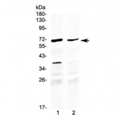 Western blot testing of human 1) HepG2 and 2) MCF7 cell lysate with MAK antibody at 0.5ug/ml. Predicted molecular weight ~70 kDa.