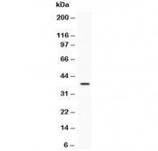 Western blot testing of recombinant human protein with IGFBP3 antibody at 0.5ug/ml. Expected molecular weight: ~31/40-44 kDa (unmodified/glycosylated).