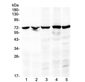 Western blot testing of 1) rat kidney, 2) mouse kidney, 3) human MCF7, 4) human 22RV1 and 5) human HeLa lysate with c-Raf antibody at 0.5ug/ml. Predicted molecular weight ~73 kDa.~