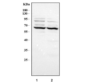 Western blot testing of 1) rat lung, 2) mouse lung, 3) human A549 and 4) human HeLa lysate with PPAR gamma antibody at 0.5ug/ml. Predicted molecular weight: 54-57 kDa, observed here at ~67 kDa.