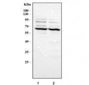 Western blot testing of 1) rat lung, 2) mouse lung, 3) human A549 and 4) human HeLa lysate with PPAR gamma antibody at 0.5ug/ml. Predicted molecular weight: 54-57 kDa, observed here at ~67 kDa.