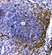 IHC staining of FFPE mouse spleen with TRAIL antibody. HIER: boil tissue sections in pH6, 10mM citrate buffer, for 20 min and allow to cool before testing.
