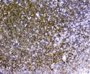 IHC staining of FFPE human tonsil with TRAIL antibody. HIER: boil tissue sections in pH6, 10mM citrate buffer, for 20 min and allow to cool before testing.
