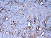 IHC testing of FFPE rat kidney tissue with Galectin 1 antibody at 1ug/ml. Required HIER: steam section in pH6 citrate buffer for 20 min and allow to cool prior to testing.