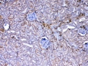 IHC testing of FFPE mouse kidney tissue with Galectin 1 antibody at 1ug/ml. Required HIER: steam section in pH6 citrate buffer for 20 min and allow to cool prior to testing.