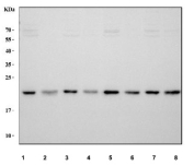 Western blot testing of human samples: 1) HeLa, 2) HL60, 3) HT29, 4) SKOV3, 5) SiHa, 6) U-2 OS, 7) PC-3 and 8) ThP-1 cell lysate with TIMP1 antibody at 0.5ug/ml. Expected molecular weight: 23-28 kDa depending on the level of glycosylation.