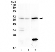 Western blot testing of mouse 1) brain, 2) liver and 3) kidney lysate with Il23r antibody at 0.5ug/ml. Expected molecular weight ~72 kDa, observed here at ~58 kDa.