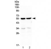 Western blot testing of 1) rat kidney and 2) mouse kidney lysate with PTP1B antibody at 0.5ug/ml. Predicted molecular weight ~50 kDa.