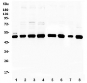 Western blot testing of human 1) placenta, 2) MCF-7, 3) Caco-2, 4) K562, 5) U-2 OS, 6) PC-3, 7) HL-60 and 8) A549 cell lysate with PTP1B antibody. Predicted molecular weight ~50 kDa.