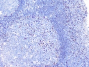 IHC staining of FFPE human tonsil with PTP1B antibody. HIER: boil tissue sections in pH6, 10mM citrate buffer, for 20 min and allow to cool before testing.