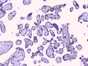 IHC staining of FFPE human placenta with PTP1B antibody. HIER: boil tissue sections in pH6, 10mM citrate buffer, for 20 min and allow to cool before testing.