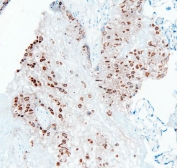IHC staining of frozen human placenta with PTP1B antibody. HIER: boil tissue sections in pH6, 10mM citrate buffer, for 20 min and allow to cool before testing.