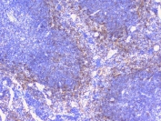 IHC staining of FFPE mouse spleen with PTP1B antibody. HIER: boil tissue sections in pH6, 10mM citrate buffer, for 20 min and allow to cool before testing.
