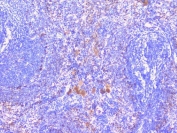 IHC staining of FFPE rat spleen with PTP1B antibody. HIER: boil tissue sections in pH6, 10mM citrate buffer, for 20 min and allow to cool before testing.