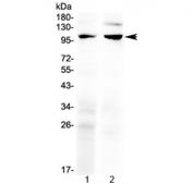 Western blot testing of 1) rat ovary and 2) rat lung lysate with TRPC6 antibody at 0.5ug/ml. Predicted molecular weight ~106 kDa.