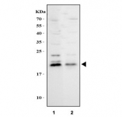 Western blot testing of human 1) RT4 and 2) HaCaT cell lysate with IL1RA antibody. Predicted molecular weight ~20 kDa.