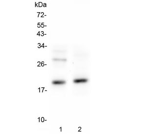 Western blot testing of 1) rat thymus and 2) mouse RAW264.7 lysate with Il1ra antibody. Expected molecular weight: 17-20 kDa.