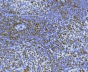 IHC staining of FFPE rat spleen tissue with Bid antibody. HIER: boil tissue sections in pH8 EDTA for 20 min and allow to cool before testing.