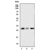 Western blot testing of mouse 1) L929, 2) spleen and 3) RAW264.7 cell lysate with Bid antibody at 0.5ug/ml. Predicted molecular weight ~22 kDa.