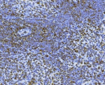 IHC staining of FFPE rat spleen tissue with Bid antibody. HIER: boil tissue sections in pH8 EDTA for 20 min and allow to cool before testing.