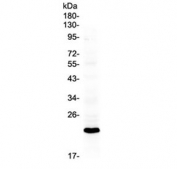 Western blot testing of mouse brain tissue with Bid antibody at 0.5ug/ml. Predicted molecular weight ~22 kDa.