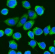 Immunofluorescent staining of FFPE human SiHa cells with DDX3 antibody (green) and DAPI nuclear stain (blue). HIER: steam section in pH6 citrate buffer for 20 min.