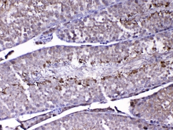 IHC testing of FFPE mouse testis tissue with DJ-1 antibody at 1ug/ml. Required HIER: steam section in pH6 citrate buffer for 20 min and allow to cool prior to testing.