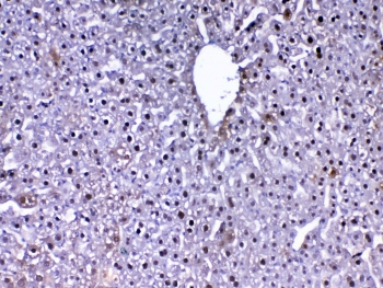 IHC testing of FFPE mouse liver tissue with DJ-1 antibody at 1ug/ml. Required HIER: steam section in pH6 citrate buffer for 20 min and allow to cool prior to testing.