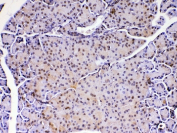 IHC testing of FFPE mouse pancreas tissue with DJ-1 antibody at 1ug/ml. Required HIER: steam section in pH6 citrate buffer for 20 min and allow to cool prior to testing.