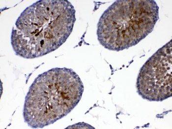 IHC testing of FFPE rat testis tissue with DJ-1 antibody at 1ug/ml. Required HIER: steam section in pH6 citrate buffer for 20 min and allow to cool prior to testing.