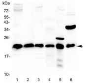 Western blot testing of 1) rat pancreas, 2) testis, 3) liver, 4) mouse pancreas, 5) mouse kidney and 6) mouse skeletal muscle lysate with DJ-1 antibody at 0.5ug/ml. Predicted molecular weight ~20 kDa.