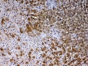 IHC testing of FFPE rat liver tissue with Park7 antibody at 1ug/ml. Required HIER: steam section in pH6 citrate buffer for 20 min and allow to cool prior to testing.