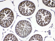 IHC testing of FFPE rat testis tissue with Park7 antibody at 1ug/ml. Required HIER: steam section in pH6 citrate buffer for 20 min and allow to cool prior to testing.