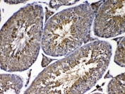 IHC testing of FFPE mouse testis tissue with Park7 antibody at 1ug/ml. Required HIER: steam section in pH6 citrate buffer for 20 min and allow to cool prior to testing.