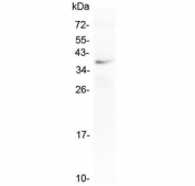 Western blot testing of human placental tissue with LOX-1 antibody at 0.5ug/ml. Predicted molecular weight: pro-form 35-50 kDa, mature form ~31 kDa.
