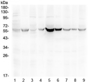 Western blot testing of 1) rat testis, 2) rat ovary, 3) mouse testis, 4) rat ovary, 5) human HeLa, 6) human MCF7, 7) human MDA-MB-231, 8) human MDA-MB-453 and 9) human SK-OV-3 lysate with ESR2 antibody at 0.5ug/ml. Predicted molecular weight: 53~59 kDa.