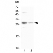 Western blot testing of 1) mouse HEPA1-6 and 2) rat kidney lysate with Oncostatin M antibody at 0.5ug/ml. Expected molecular weight ~28 kDa (precursor), ~24 kDa (pro form), ~28 kDa (glycosylated pro form).