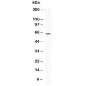 Western blot testing of recombinant human protein with LBP antibody at 0.5ug/ml. Predicted molecular weight ~53 kDa (unmodified), 60-65 kDa (glycosylated).