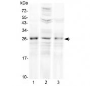 Western blot testing of 1) rat ovary, 2) human HeLa and 3) human placenta lysate with FGF8 antibody at 0.5ug/ml. Predicted molecular weight ~25 kDa.