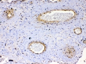 IHC testing of FFPE human placenta tissue with VEGFR2 antibody at 1ug/ml. Required HIER: steam section in pH6 citrate buffer for 20 min and allow to cool prior to testing.