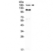 Western blot testing of human MCF7 cell lysate with VEGFR2 antibody at 0.5ug/ml. Predicted molecular weight: ~152 (immature), 180-200 kDa (intermediate) and 220-230 kDa (mature).