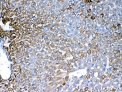IHC testing of FFPE mouse liver tissue with IGFBP1 antibody at 1ug/ml. Required HIER: steam section in pH6 citrate buffer for 20 min and allow to cool prior to testing.