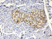 IHC testing of FFPE rat pancreas tissue with IGFBP1 antibody at 1ug/ml. Required HIER: steam section in pH6 citrate buffer for 20 min and allow to cool prior to testing.
