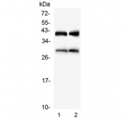 Western blot testing of 1) rat liver and 2) mouse liver lysate with IGFBP1 antibody. Expected molecular weight: 28-35 kDa.