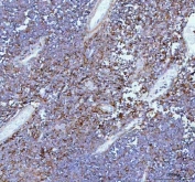 IHC staining of FFPE mouse thymus tissue with IL22 antibody. HIER: boil tissue sections in pH8 EDTA for 20 min and allow to cool before testing.