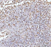 IHC staining of FFPE human spleen tissue with IL22 antibody. HIER: boil tissue sections in pH8 EDTA for 20 min and allow to cool before testing.
