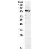 Western blot testing of human K562 cell lysate with NFAT1 antibody at 0.5ug/ml. Predicted molecular weight ~100 kDa.
