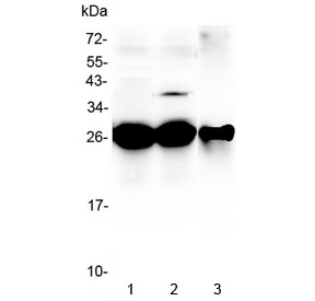 Western blot testing of 1) rat liver, 2) mouse liver and 3) mouse HEPA1-6 lysate with MBL2 antibody at 0.5ug/ml. Predicted molecular weight ~26 kDa.~