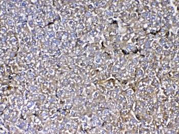 IHC testing of FFPE rat liver tissue with MBL2 antibody at 1ug/ml. Required HIER: steam section i