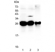 Western blot testing of 1) rat liver, 2) mouse liver and 3) mouse HEPA1-6 lysate with MBL2 antibody at 0.5ug/ml. Predicted molecular weight ~26 kDa.